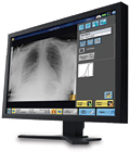 Carestream Mammography image on monitor